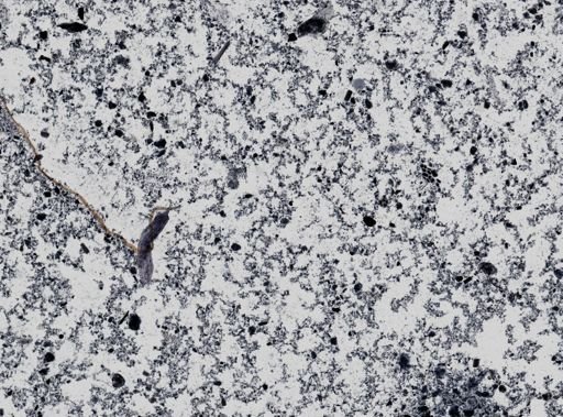 Giardia lamblia