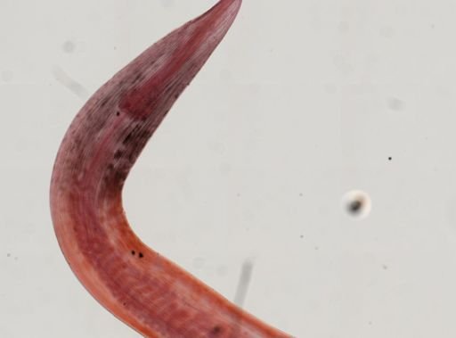 Heterakis gallinae