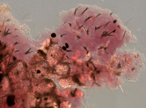 Acanthancora sp.
