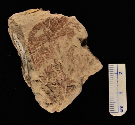 Anemia stricta