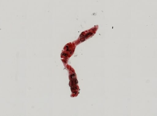 Trematoda
