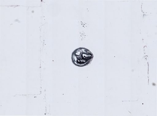 Myopsida