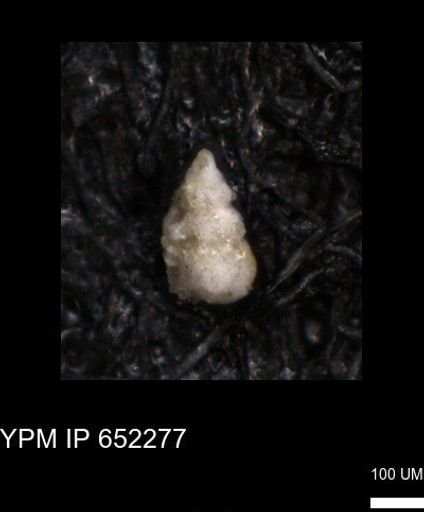 undet. Foraminiferida
