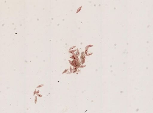 Paramecium caudatum