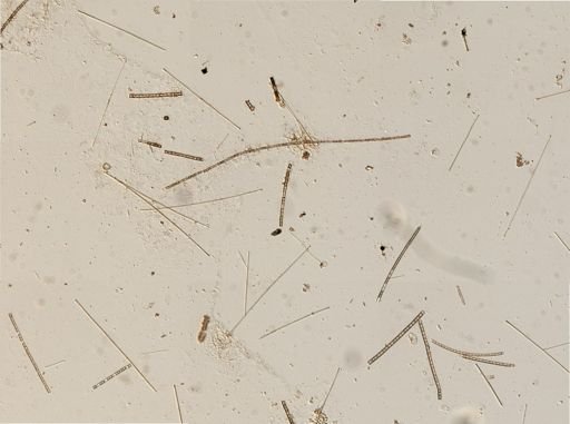 Bacillariophyceae