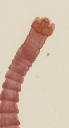 Dipylidium caninum
