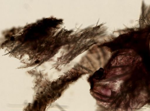 Tedania suctoria