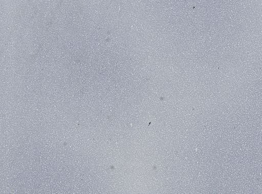 Plasmodium vivax