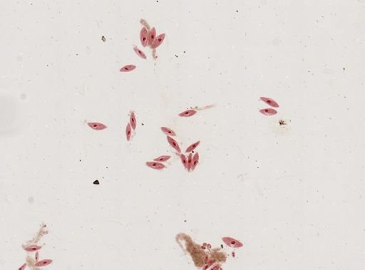 Paramecium