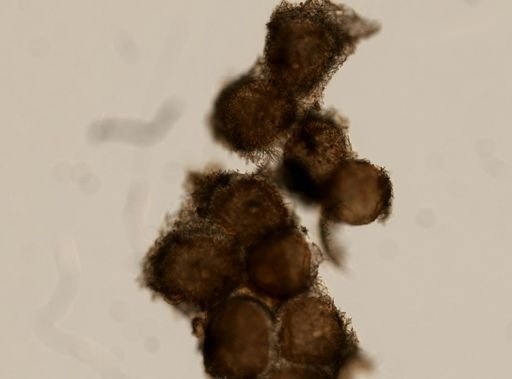 Spongilla fragilis