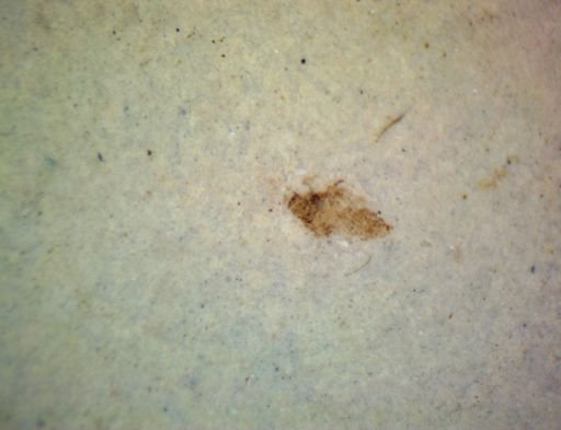 undet. Hexapoda