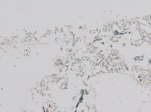 Neofibularia nolitangere