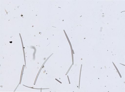 Didiscus