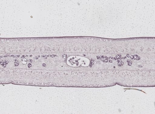 Taenia saginata