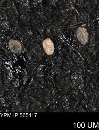Spirolocammina planula