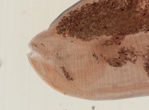 Oligacanthorhynchus microcephalus