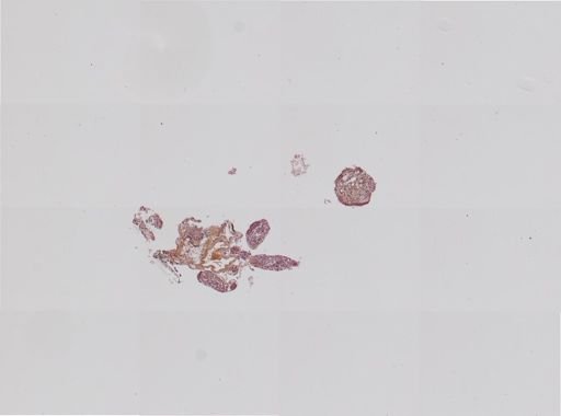 Fasciola hepatica