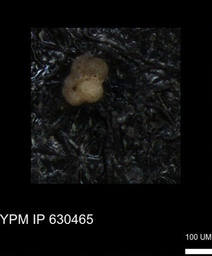 undet. Rugoglobigerinidae