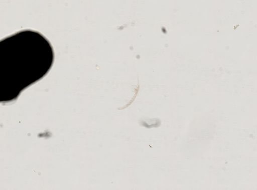 Derocheilocaris typica