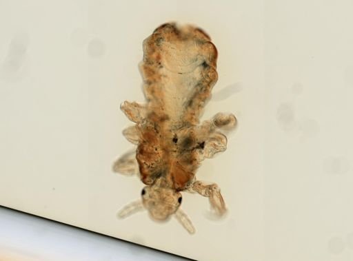 Pediculus humanus