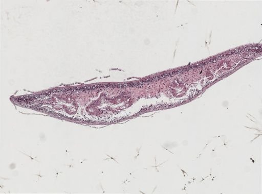 Phagocata gracilis