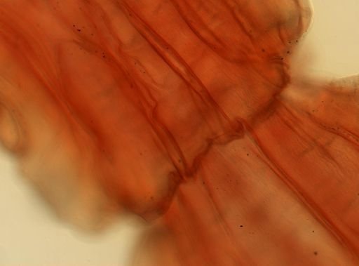 Taenia saginata