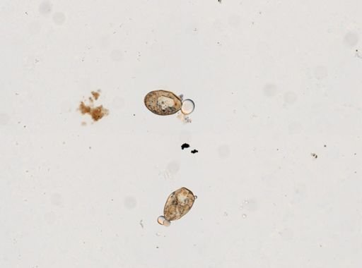 Fasciolopsis buski