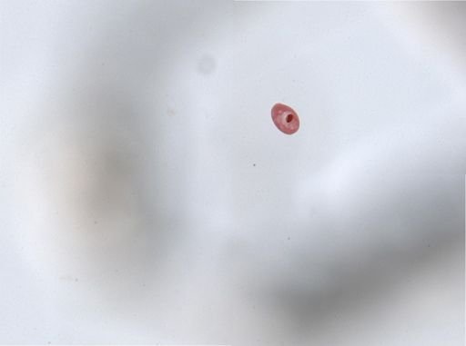 Paramecium aurelia