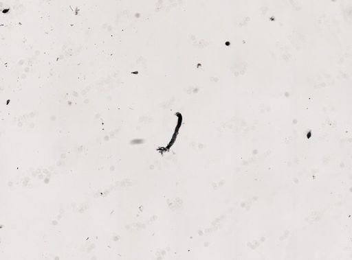 Protozoa