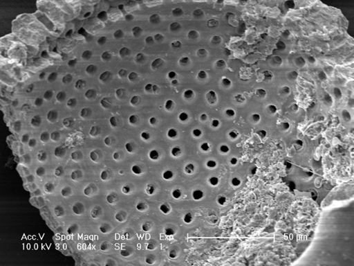 Neogloboquadrina dutertrei