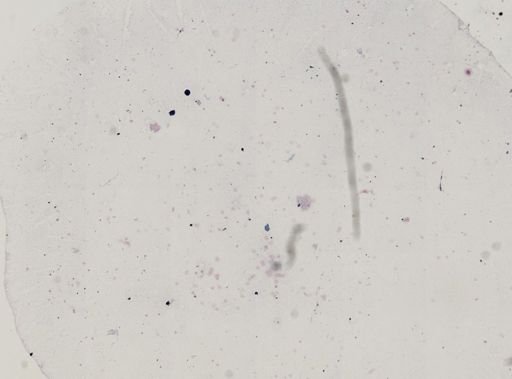 Plasmodium vivax