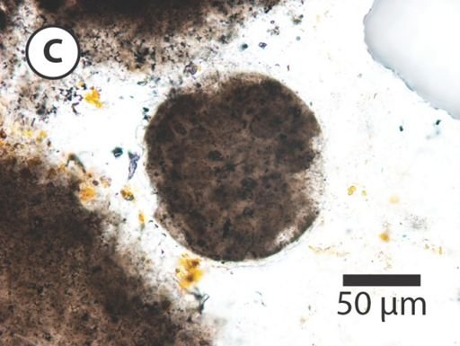 Megasphaera miniscula