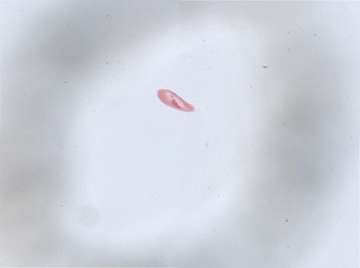 Paramecium aurelia