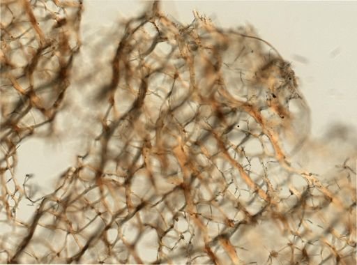 Callyspongia vaginalis