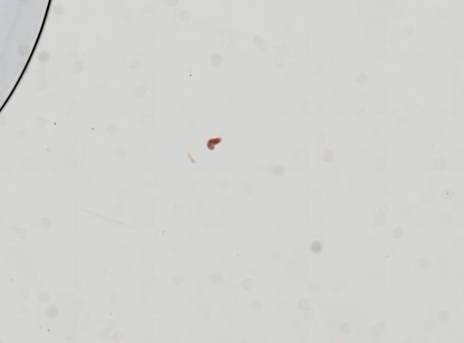 Trematoda