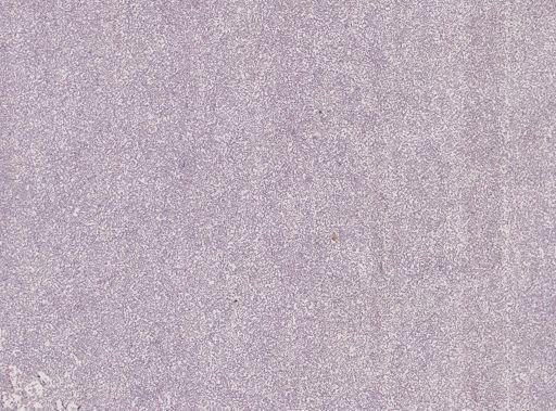 Plasmodium relictum