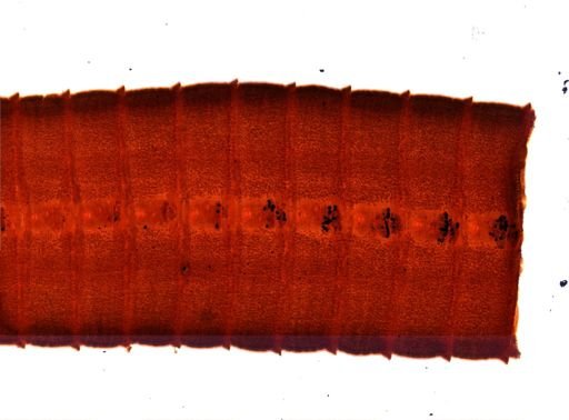 Diphyllobothrium erinacei