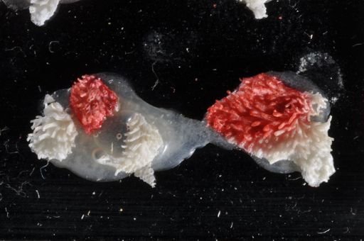 Bryozoa