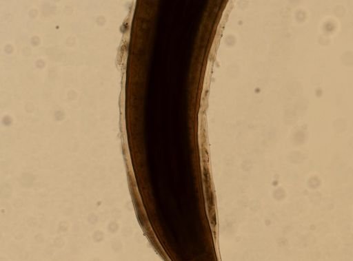 Anisakis