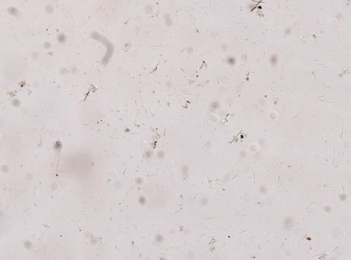 Callyspongia sp.