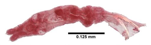 Gyrodactylus