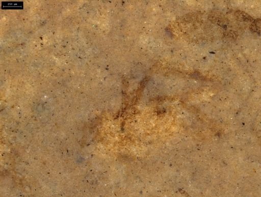 undet. Arachnida