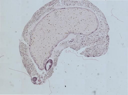 Andricus glandulae