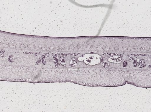 Taenia saginata