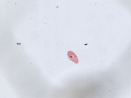 Paramecium aurelia