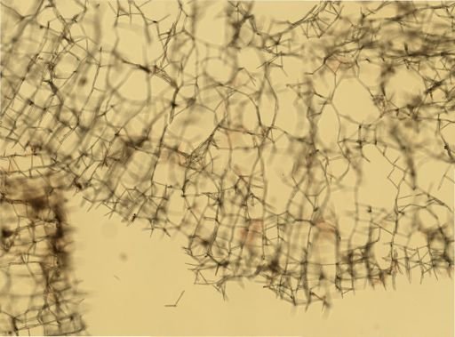 Haliclona oculata