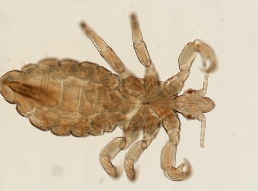Pediculus humanus