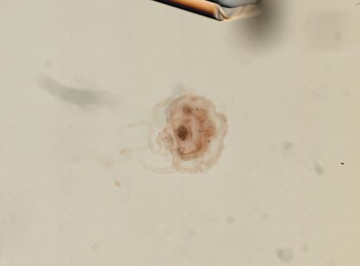 Cnidaria