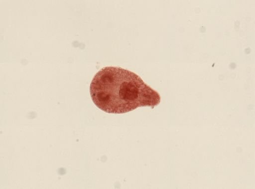 Tetracotyle