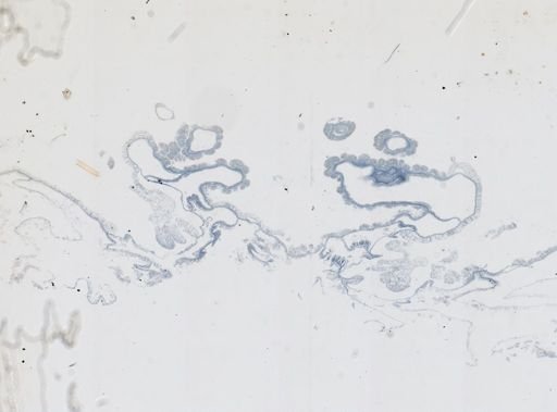 Astrangia poculata